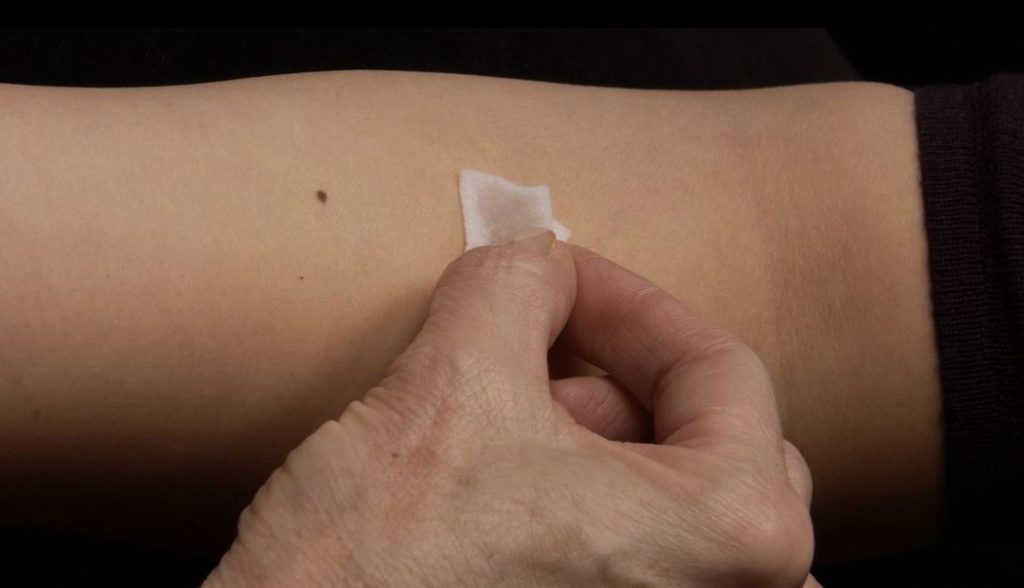 Contra Costa expands monkeypox vaccine eligibility